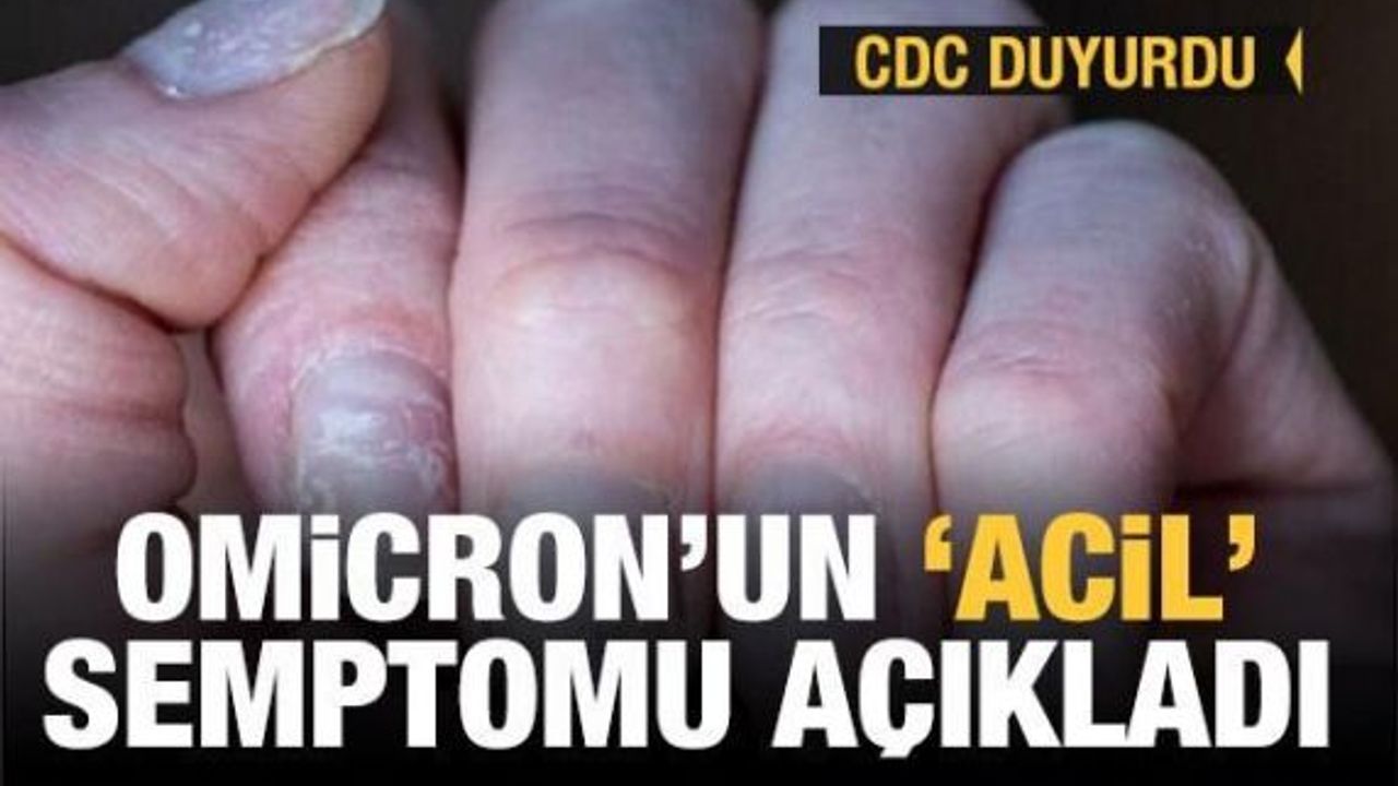 Son dakika: CDC duyurdu! Omicron'un 'acil' semptomu açıklandı